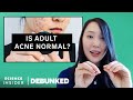 Skincare Myths Debunked Quiz