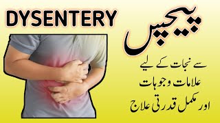 How to cure loose motion at home || Pechas or dast ka ilaj