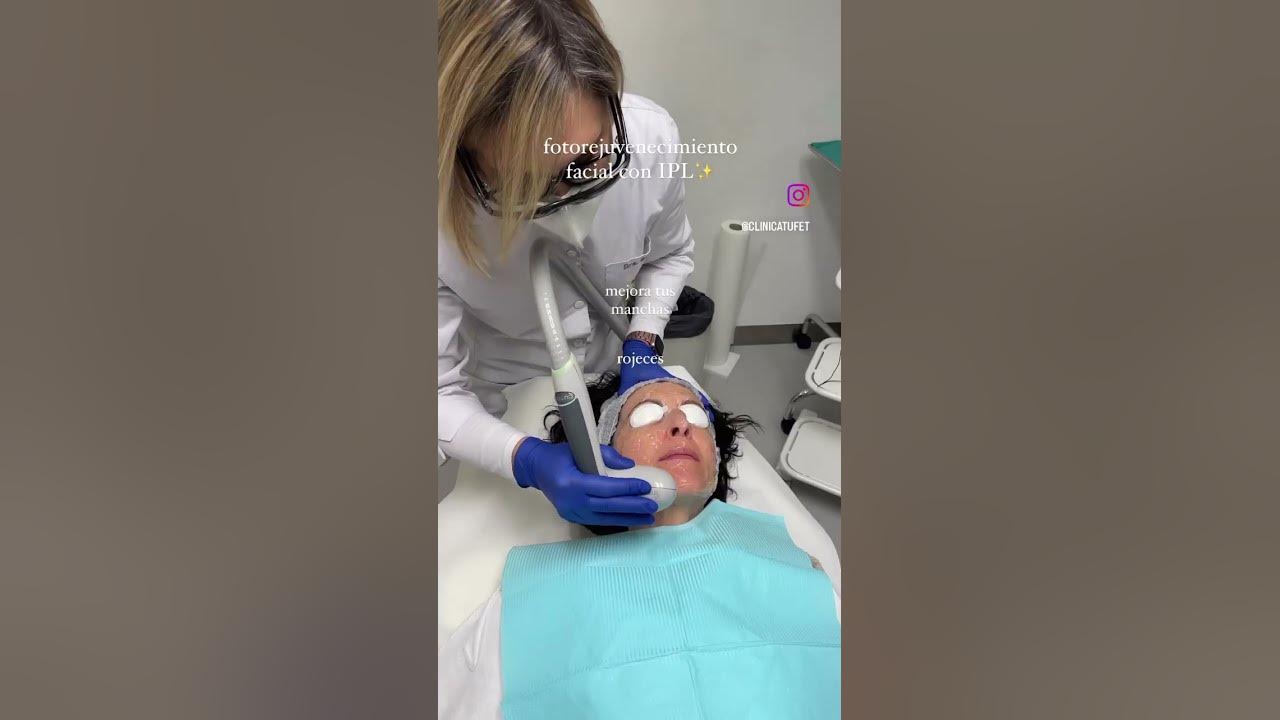 Rejuvenecimiento Facial: Luz Pulsada IPL- Oftalvist