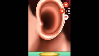 미친 귀 의사 아이게임 screenshot 1