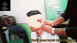 How to do Eye Bandaging || Nursing procedure || Eye Bandage #medicalknowledge360 #bandage #nursing