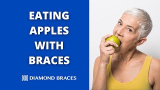 Can I Eat An Apple With Braces?