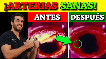 ¿Cómo destapar las arterias de forma natural?