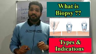 What is Biopsy  Indication and types of biopsy