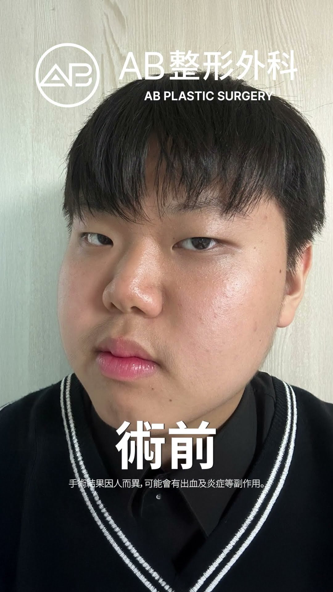 從平凡到非凡：他令人驚嘆的蛻變！#热门 #推荐