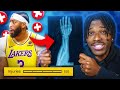 I Turned Injuries To 100 In NBA 2K24