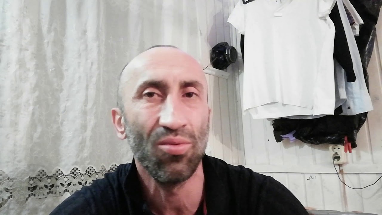 Лысый армянин. Лысый азербайджанец. Прическа лысого азербайджанца. Лысый азербайджанец с бородой