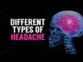 HEADACHE: Migraine, Stress, Sinus. Stroke Payo ni Doc Willie Ong #503b