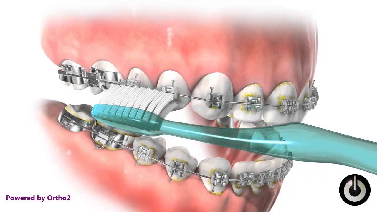 Oral Hygiene YouTube