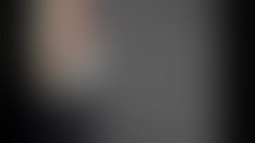 Extreme Pedal and Digital Access – How? - Peter Soukas, MD