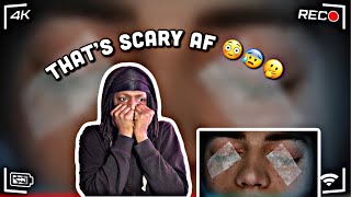 MR BALLEN HE EXPERIENCED THE WORST MEDICAL SCREW UP EVER  (MATURE AUDIENCE ONLY) REACTION