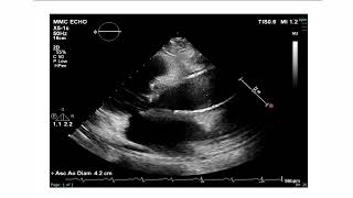 Cardiac Case Studies Series: Valvular Disease-Sample Excerpt