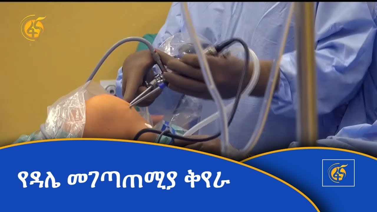 የዳሌ መገጣጠሚያ ቅየራ