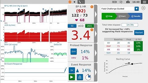How to give a guided fluid challenge | LiDCO (US)
