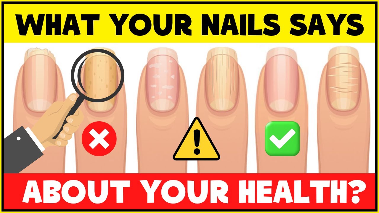 Skincare FAQs | What Your Nails are Saying About Your Health