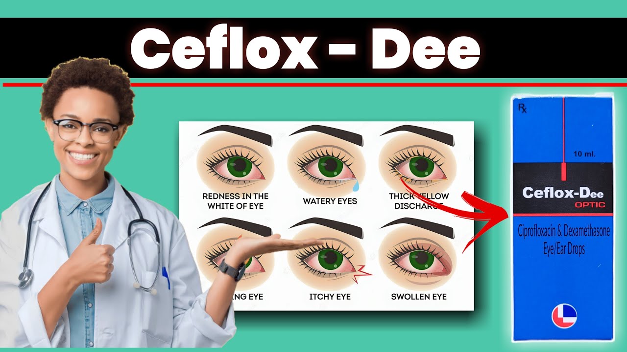 Ceflox Dee Ceflox dee optic uses in hindi Ceflox drops ऑख, कान मे