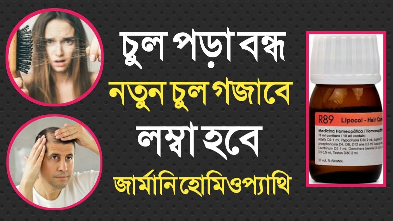 চুল পড়া বন্ধ করতে চুল ঘন ও লম্বা করতে এই সফল হোমিওপ্যাথি ঔষধ | Hair Fall Loss Treatment in Bangla