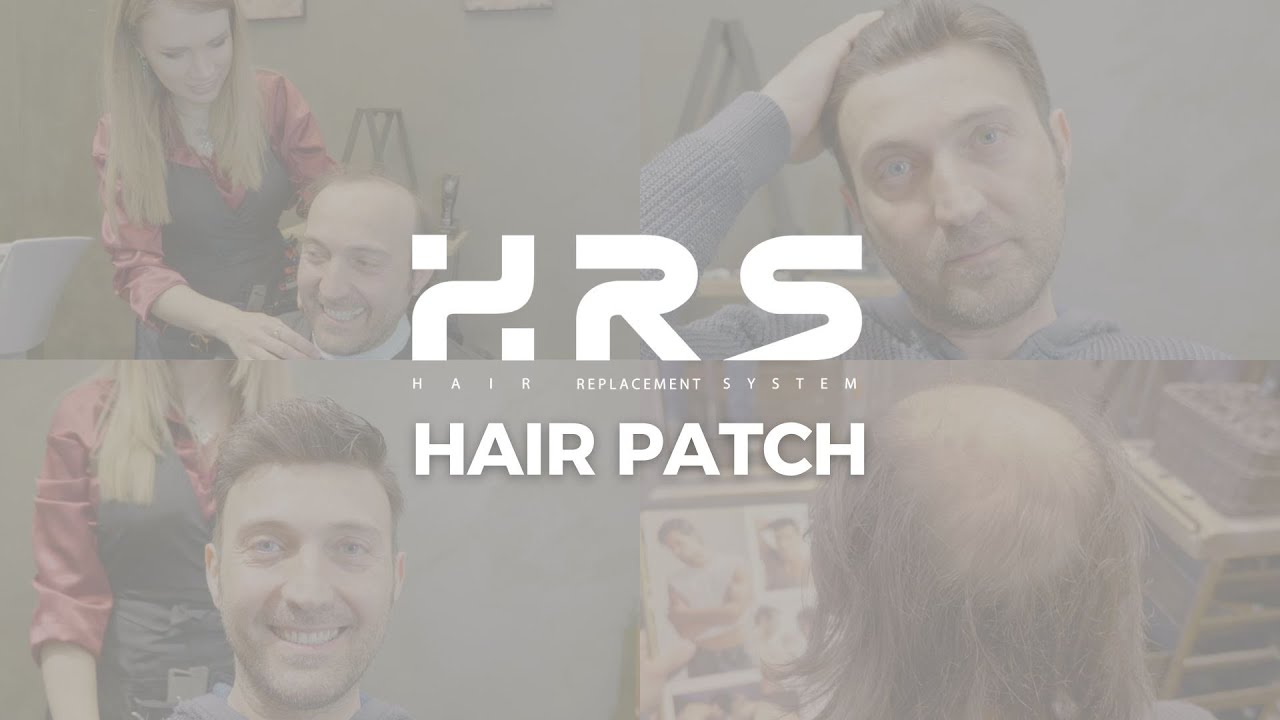 Hair Patch su misura