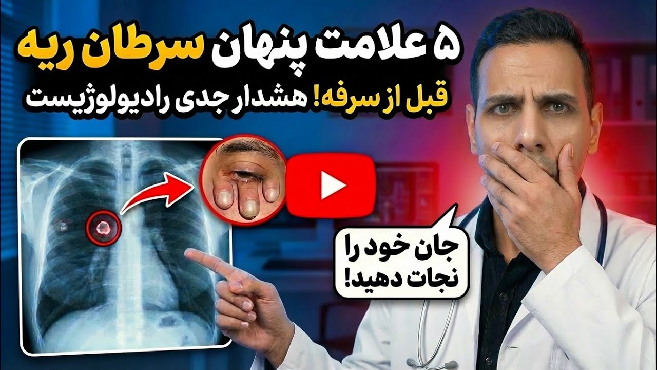 چشمانتان راز سرطان ریه را فاش می‌کنند! (هشدار یک رادیولوژیست)