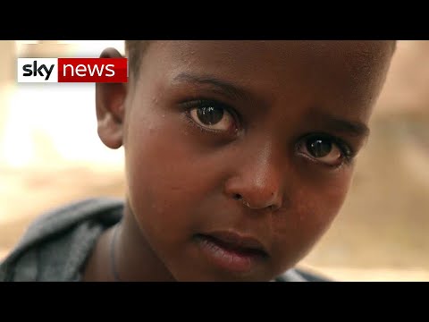 Shot in the head: A human catastrophe unfolds in Ethiopia