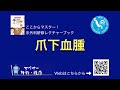 ここからマスター：爪下血腫