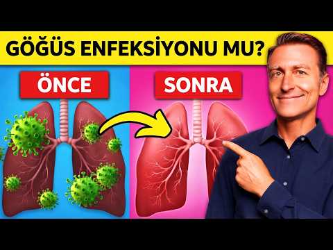 Göğüs Enfeksiyonu İçin 7 Doğal Destek! 7’ncisi Şaşırtıyor