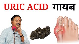 Uric Acid Treatment || Uric acid kaa ilaj Hindi me || Gout