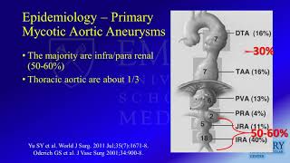 Mycotic Aortic Aneurysms