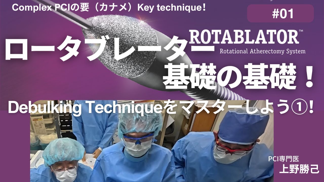 Debulking Techniqueをマスターしよう①！ロータブレーター 基礎の基礎！