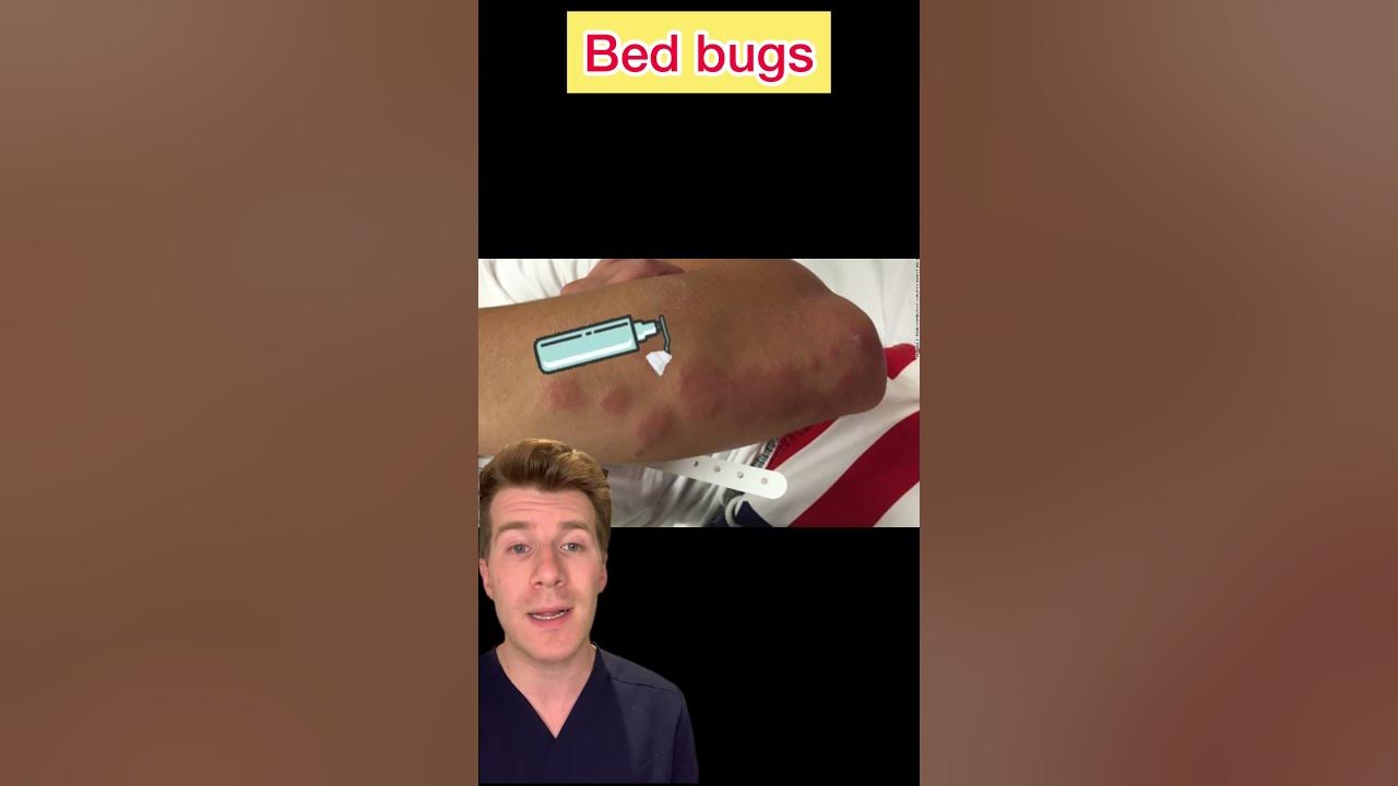 BED BUGS EXPLAINED IN UNDER 60 SECONDS shorts medical doctor 