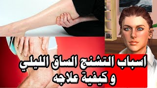 اسباب التشنج الساق الليلي و كيفية علاجه