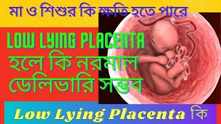 Low Lying Placenta during pregnancy in bengali | Low lying placenta থাকলে কি নরমাল ডেলিভারি সম্ভব |