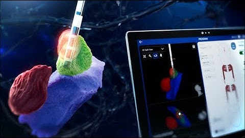 Boston Scientific’s next innovation in Image Guided Programming, Vercise™ Neural Navigator 5 (VN5)