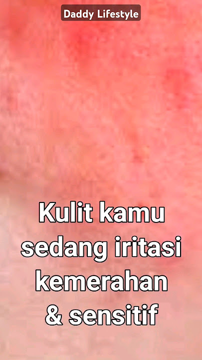 OVERCOME IRRITATED, SENSITIVE AND RED SKIN #skincareskincaresensitive