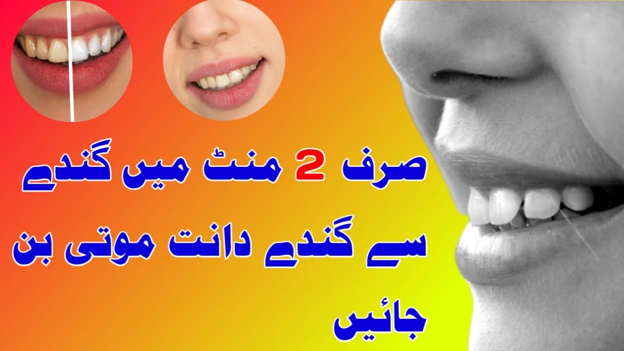 How To Whiten Teeth At Home | Clean Your Teeth - YouTube