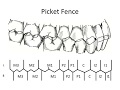 STATIC OCCLUSION - Occlusal Contacts & Picket Fence STATIC OCCLUSION - Occlusal Contacts & Picket Fence
