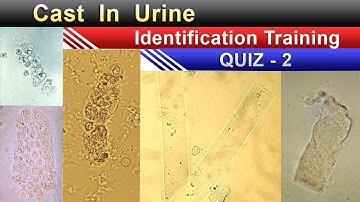 Urine Cast Identification Training Quiz -2