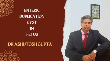 Enteric Duplication Cyst in Fetus