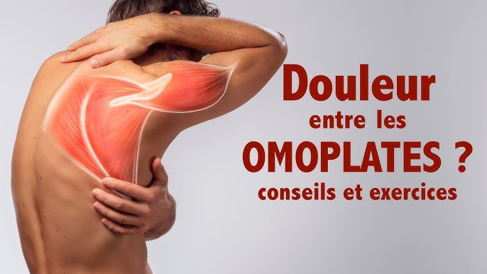 Soulager la douleur intercostale: conseils et exercices - YouTube