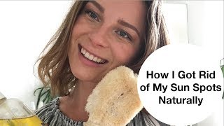 How I Got Rid of My Sun Spots, Naturally  |  5 Top Tips To Get Rid of Sun Spots How To Get Rid Of Sunspots On Your Skin