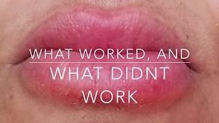 Cure a LIP Allergy! Big swollen, cracked & painful lips!! What works, what doesn't
