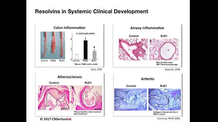 Charles Serhan | Resolvins and Pro-Resolving Receptor Mechanisms in Inflammation and Infections