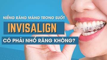 Niềng răng máng trong suốt Invisalign có phải nhổ răng không | Tt Niềng Răng quốc tế Diamond