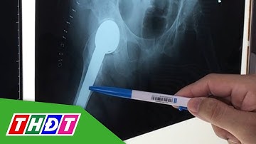 Cần Thơ: Thay khớp háng bán phần thành công cho cụ bà 100 tuổi | THDT