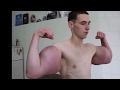 Synthol Kid gets his arms drained