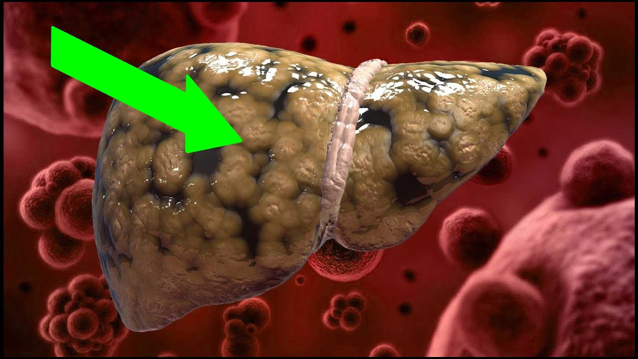 6 Foods That Naturally Cleanse the Liver - YouTube