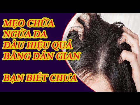 mẹo chữa ngứa da đầu bằng đông y đơn giản hiệu quả