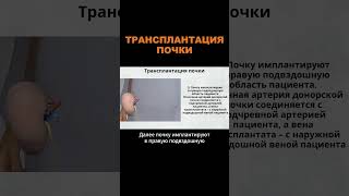 Как проводится ПЕРЕСАДКА ПОЧКИ в ТУРЦИИ? #меднавигатор #лечениевтурции #турция