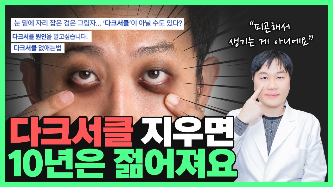 잠을 푹 자도 없어지지 않는 다크서클 | '이것'이 원인입니다!