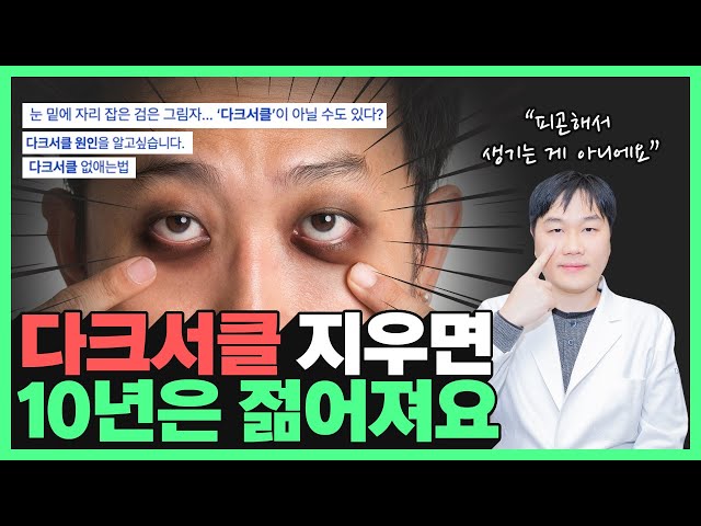 잠을 푹 자도 없어지지 않는 다크서클 | '이것'이 원인입니다!